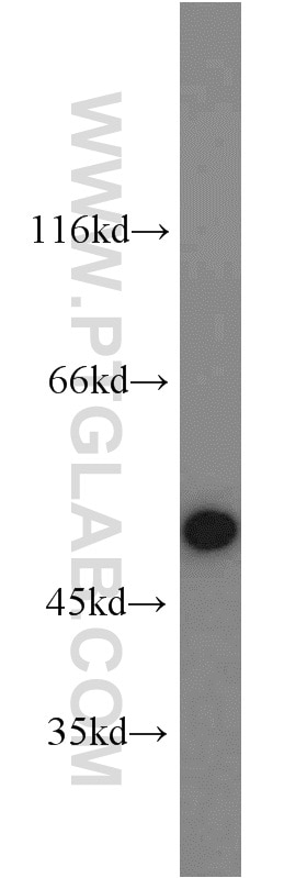 Western Blot (WB) analysis of Raji cells using RBM22 Polyclonal antibody (22103-1-AP)