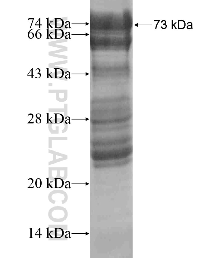 RBM22 fusion protein Ag17315 SDS-PAGE
