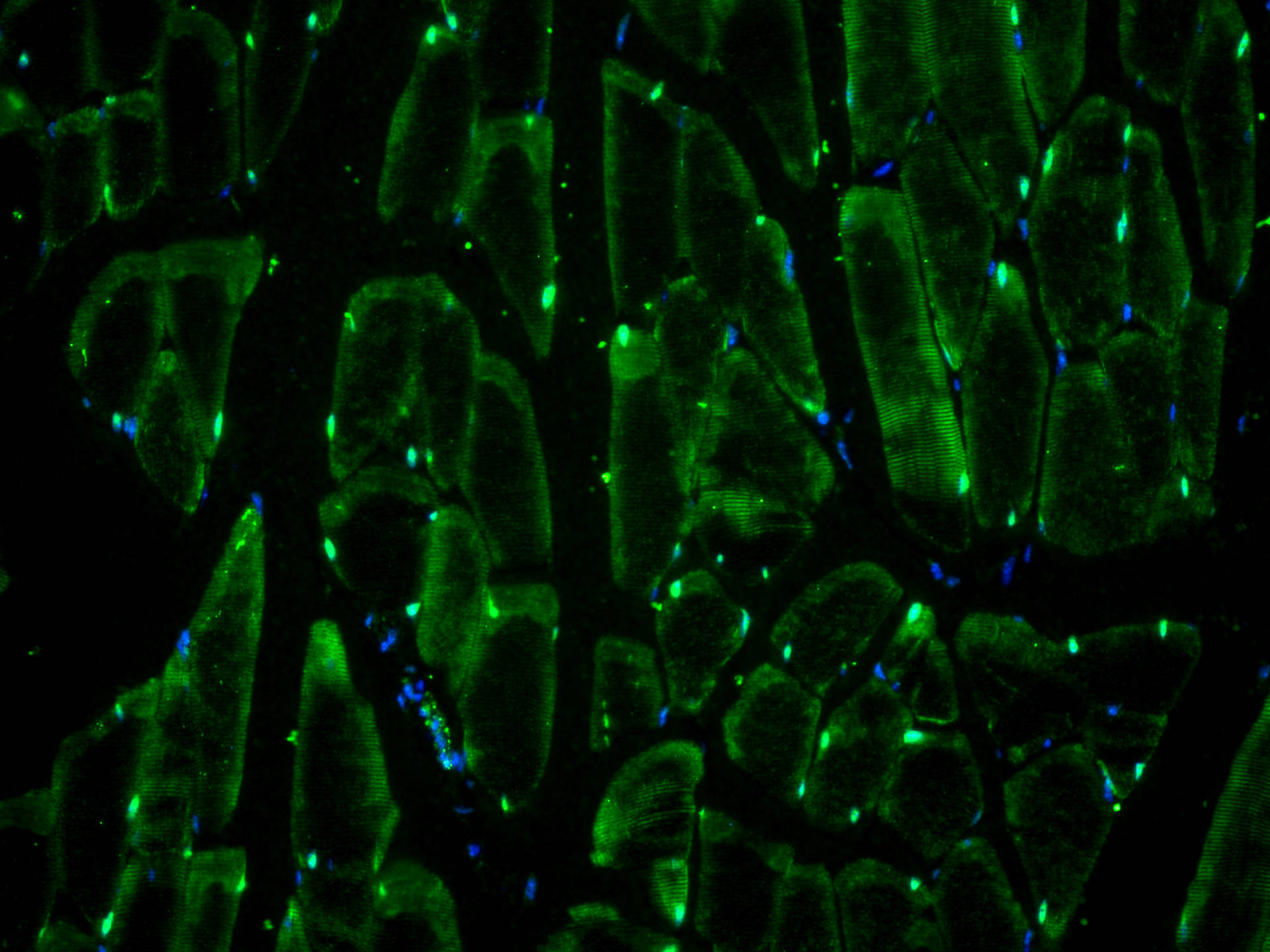 IF Staining of mouse skeletal muscle using 18178-1-AP
