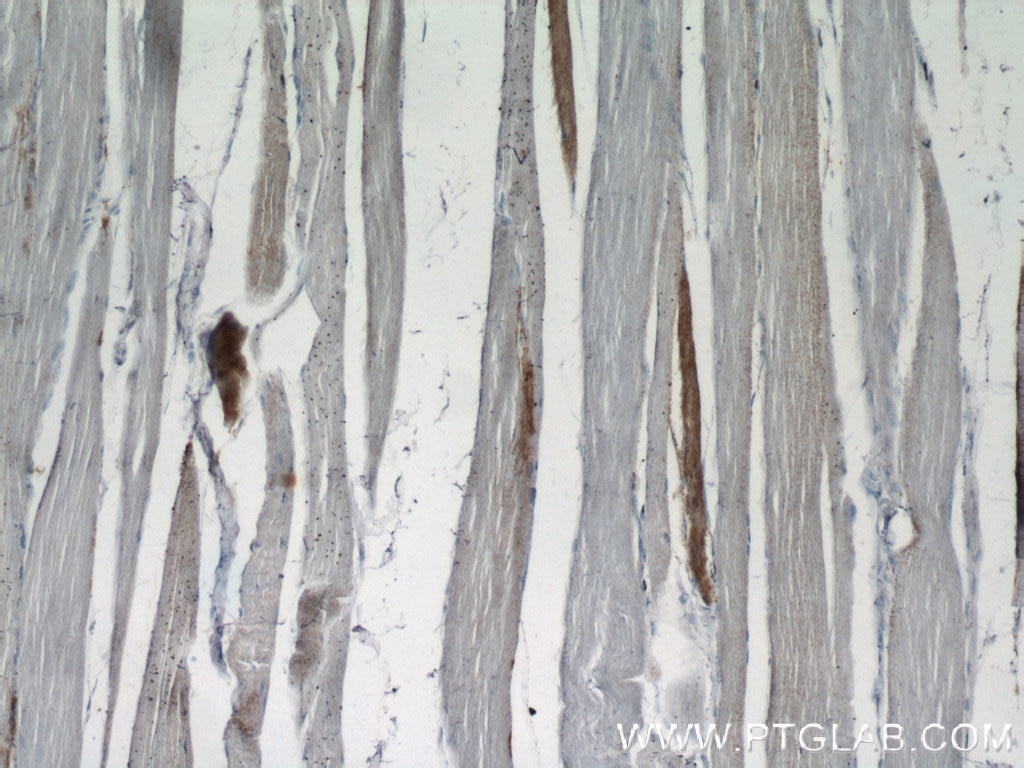 IHC staining of human skeletal muscle using 18178-1-AP