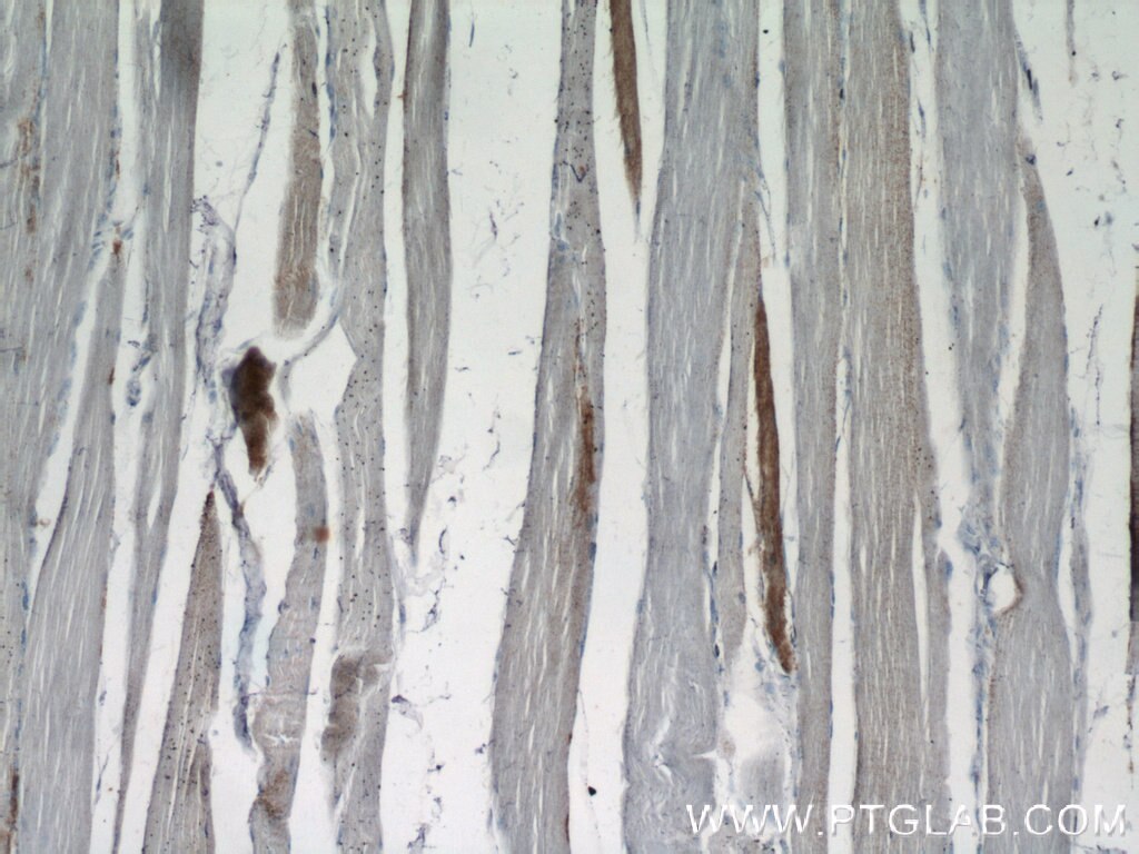 Immunohistochemistry (IHC) staining of human skeletal muscle tissue using RBM24 Polyclonal antibody (18178-1-AP)