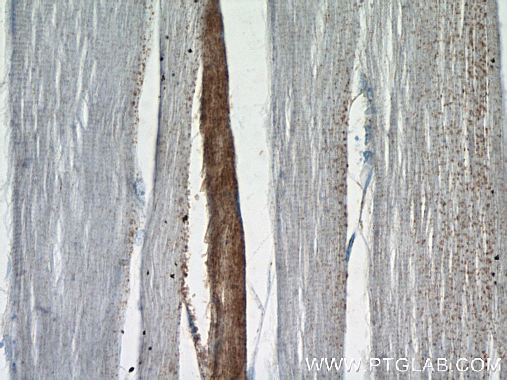 Immunohistochemistry (IHC) staining of human skeletal muscle tissue using RBM24 Polyclonal antibody (18178-1-AP)