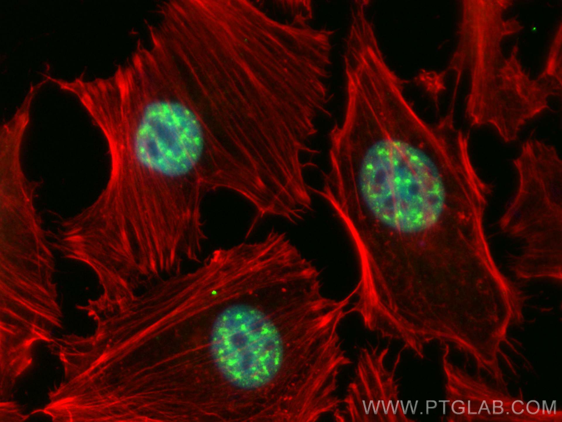Immunofluorescence (IF) / fluorescent staining of HeLa cells using RBM25 Polyclonal antibody (25297-1-AP)