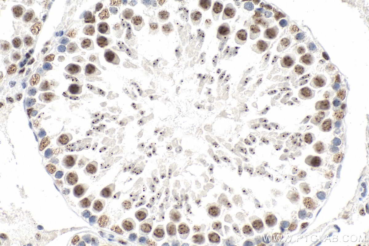 IHC staining of rat testis using 25297-1-AP Immunohistochemistry (IHC) staining of rat testis tissue using RBM25 Polyclonal antibody (25297-1-AP)