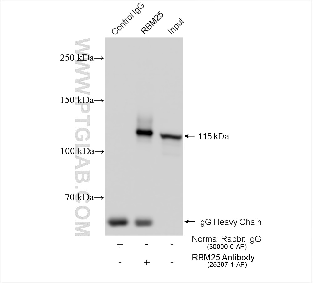 Immunoprecipitation (IP) experiment of HEK-293 cells using RBM25 Polyclonal antibody (25297-1-AP)