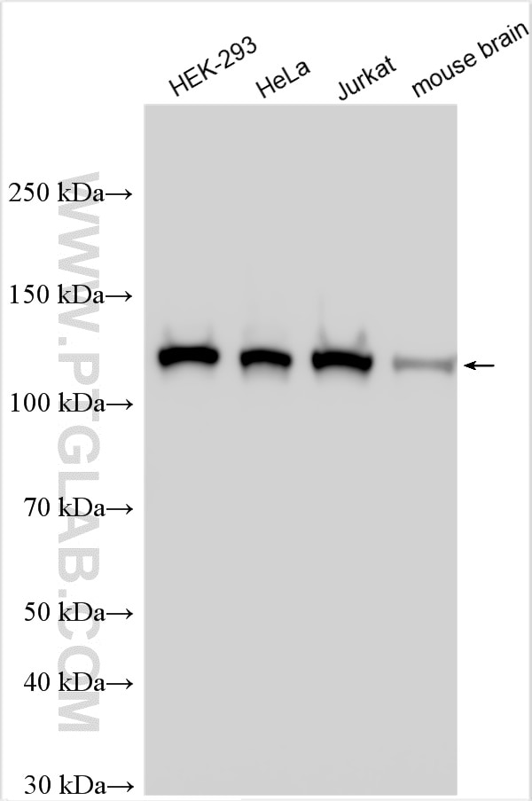 Western Blot (WB) analysis of various lysates using RBM25 Polyclonal antibody (25297-1-AP)