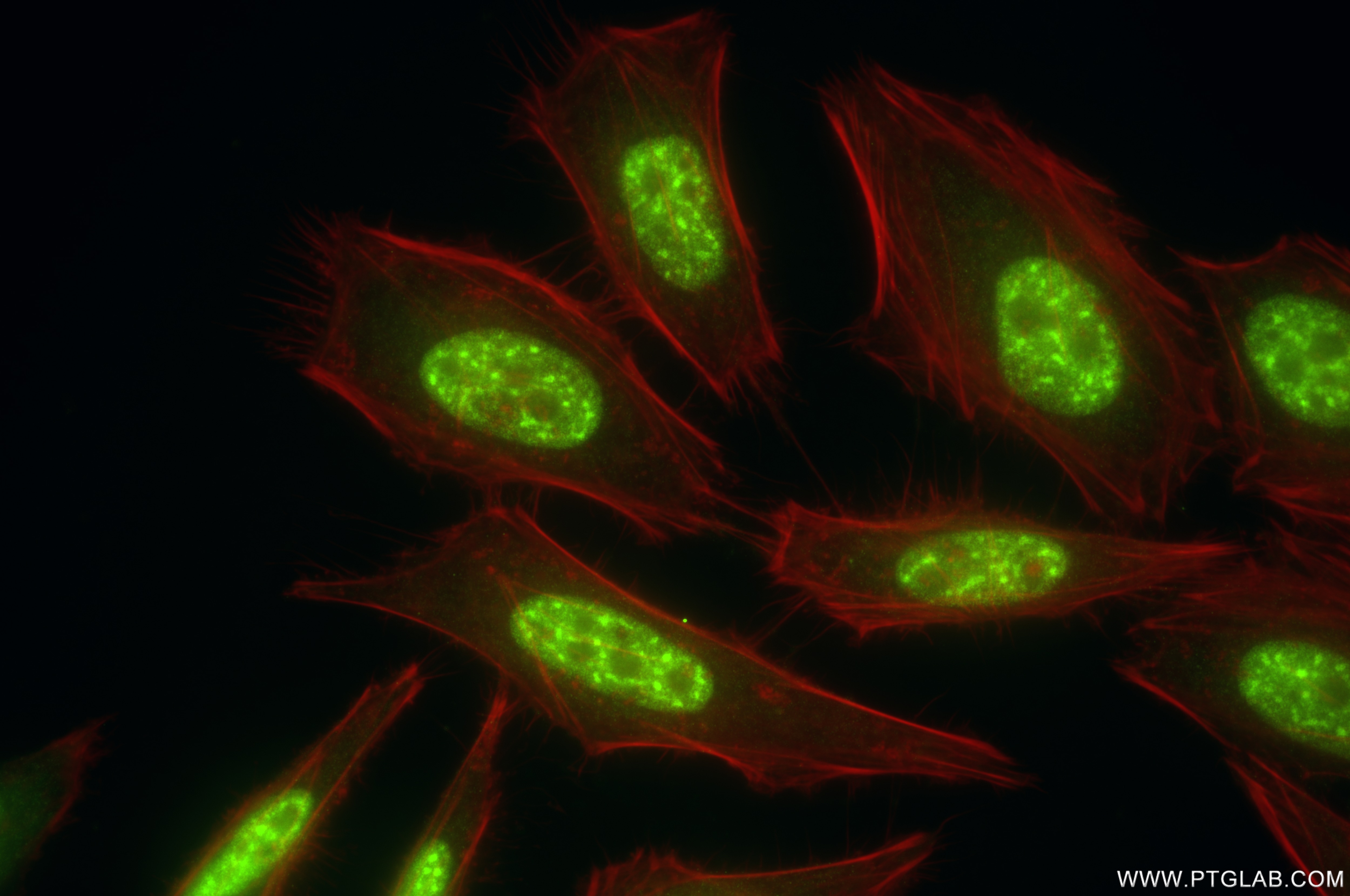 Immunofluorescence (IF) / fluorescent staining of HeLa cells using RBM25 Recombinant antibody (84968-4-RR)