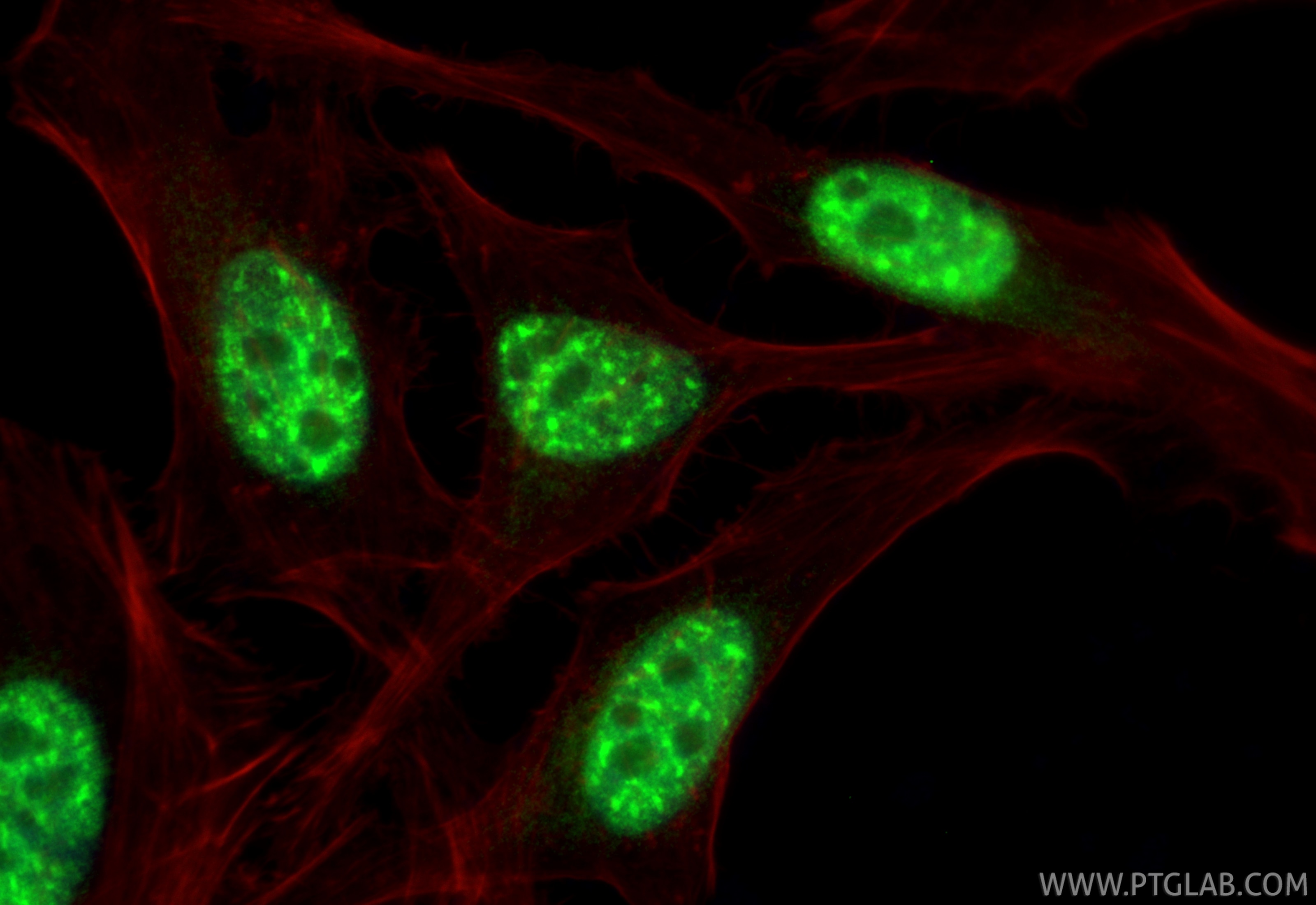Immunofluorescence (IF) / fluorescent staining of HeLa cells using Multi-rAb® RBM25 Multi-Recombinant antibody (RMX00066)