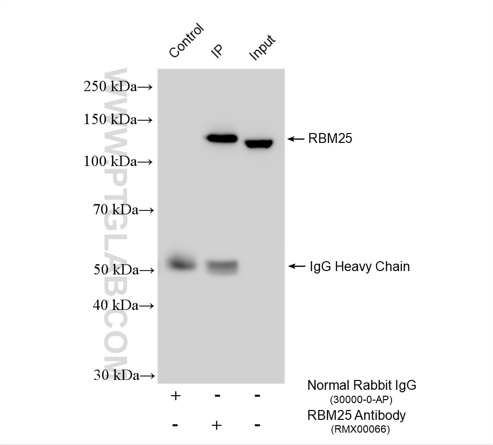Immunoprecipitation (IP) experiment of HEK-293 cells using Multi-rAb® RBM25 Multi-Recombinant antibody (RMX00066)