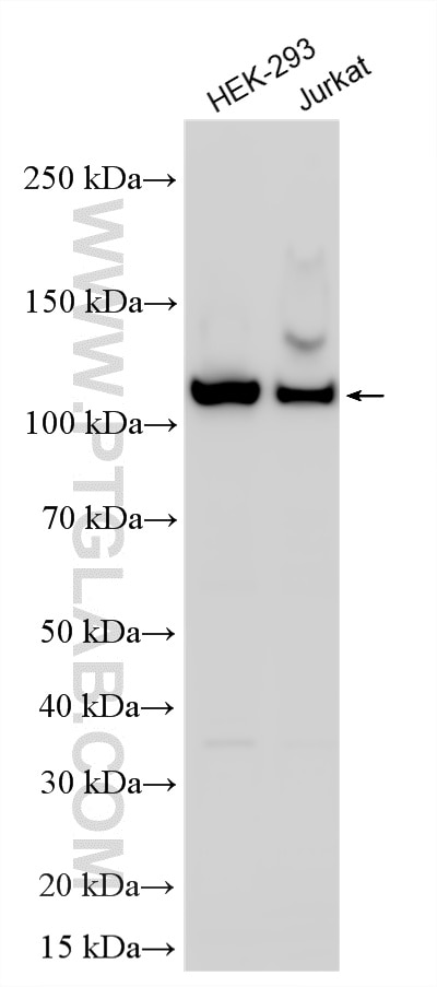Western Blot (WB) analysis of various lysates using Multi-rAb® RBM25 Multi-Recombinant antibody (RMX00066)
