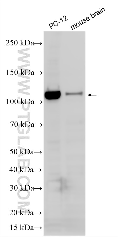 Western Blot (WB) analysis of various lysates using Multi-rAb® RBM25 Multi-Recombinant antibody (RMX00066)