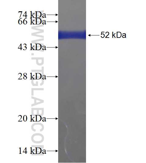 RBM25 fusion protein Ag18244 SDS-PAGE