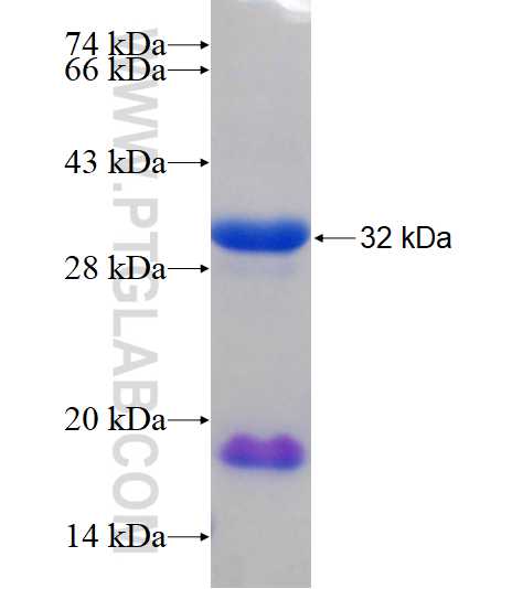 RBM25 fusion protein Ag18467 SDS-PAGE