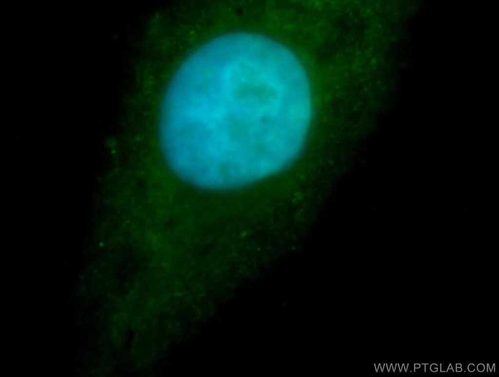 Immunofluorescence (IF) / fluorescent staining of HepG2 cells using RBM26 Polyclonal antibody (16823-1-AP)