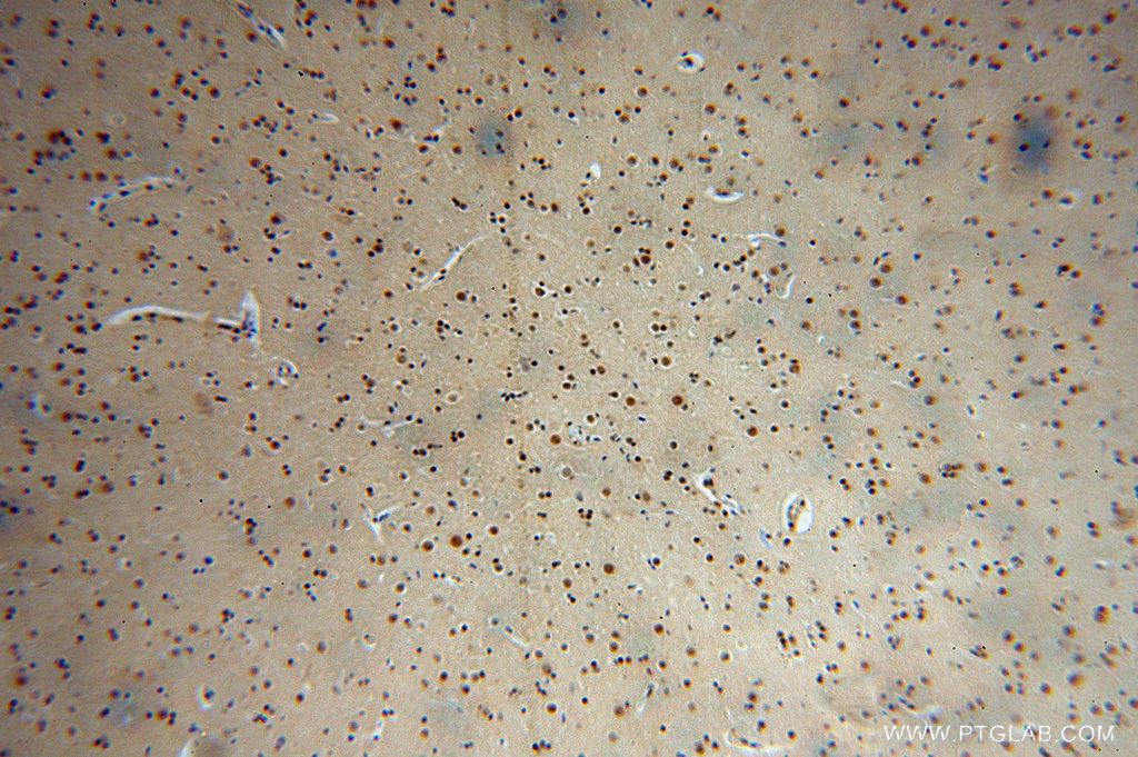 Immunohistochemistry (IHC) staining of human brain tissue using RBM26 Polyclonal antibody (16823-1-AP)