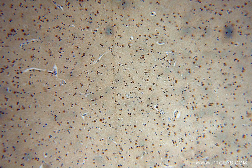 Immunohistochemistry (IHC) staining of human brain tissue using RBM26 Polyclonal antibody (16823-1-AP)