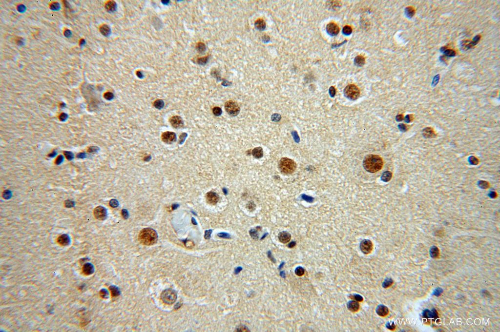 Immunohistochemistry (IHC) staining of human brain tissue using RBM26 Polyclonal antibody (16823-1-AP)