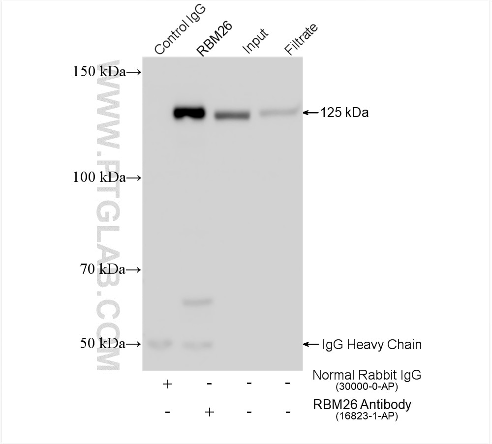 Immunoprecipitation (IP) experiment of HEK-293 cells using RBM26 Polyclonal antibody (16823-1-AP)