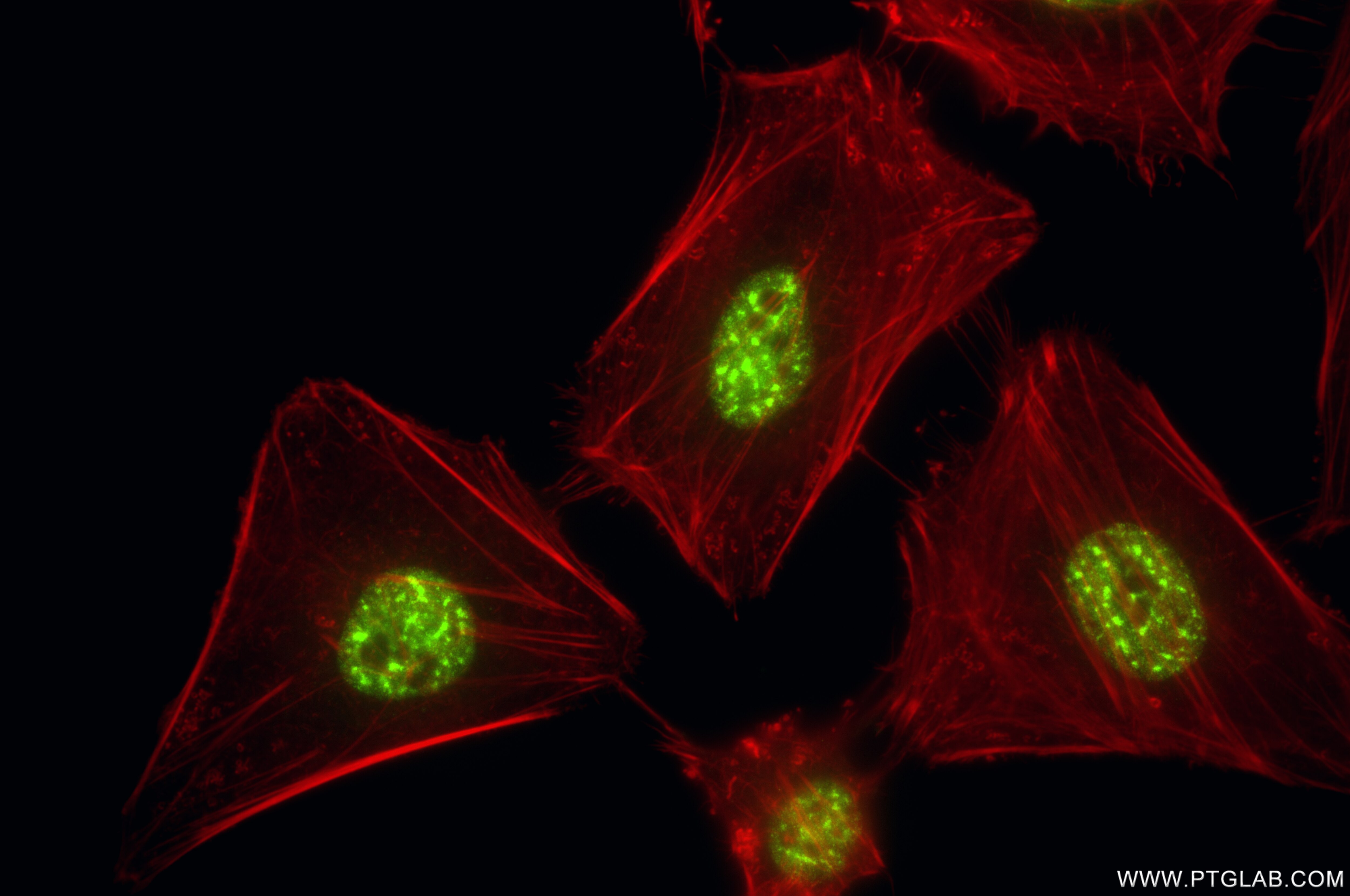 Immunofluorescence (IF) / fluorescent staining of HeLa cells using RBM26 Recombinant antibody (86302-1-RR)