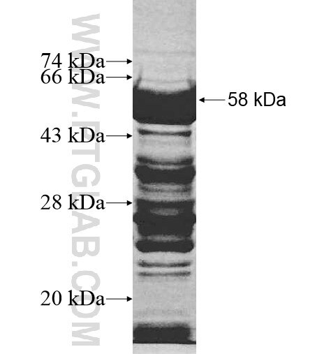 RBM26 fusion protein Ag10398 SDS-PAGE