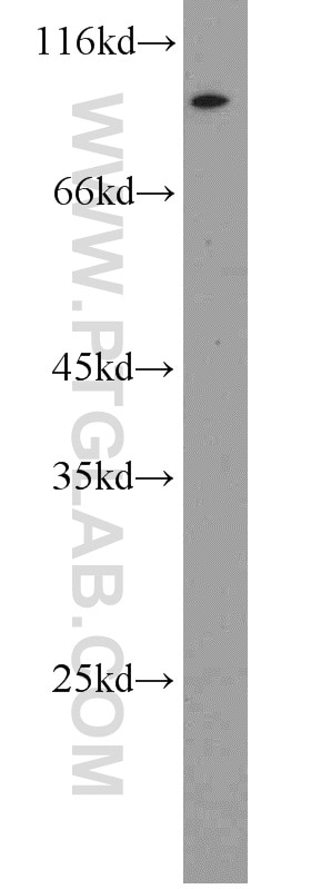 Western Blot (WB) analysis of NIH/3T3 cells using RBM28 Polyclonal antibody (16484-1-AP)