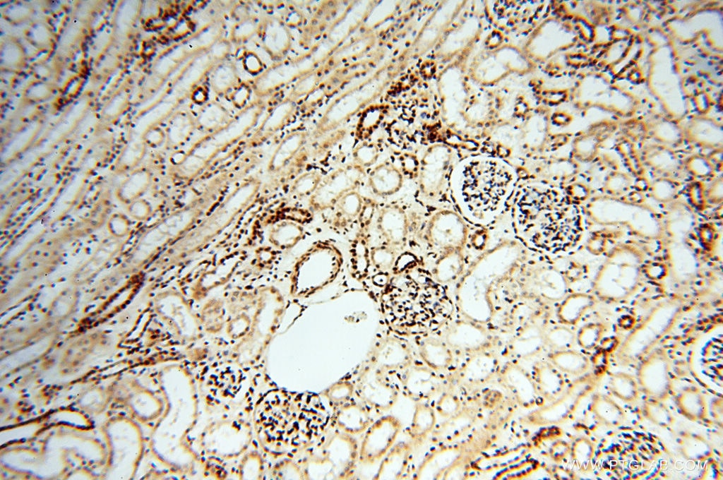 Immunohistochemistry (IHC) staining of human kidney tissue using RBM3 Polyclonal antibody (14363-1-AP)