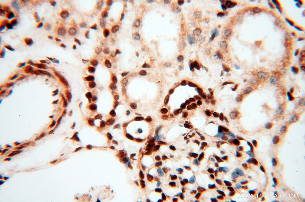 Immunohistochemistry (IHC) staining of human kidney tissue using RBM3 Polyclonal antibody (14363-1-AP)