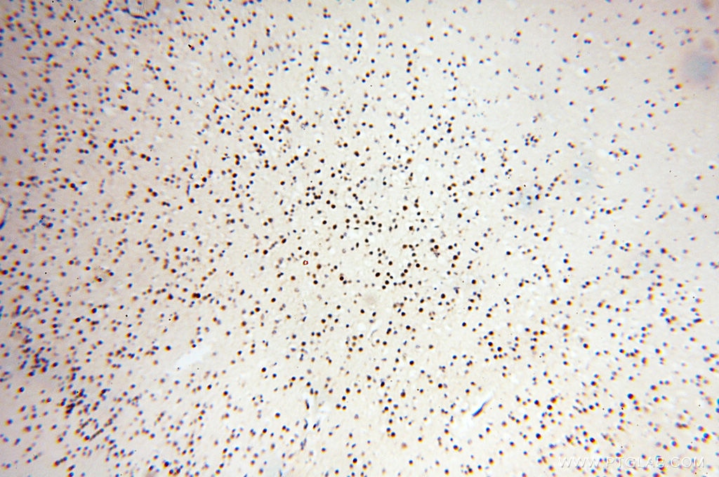 IHC staining of human brain using 14363-1-AP