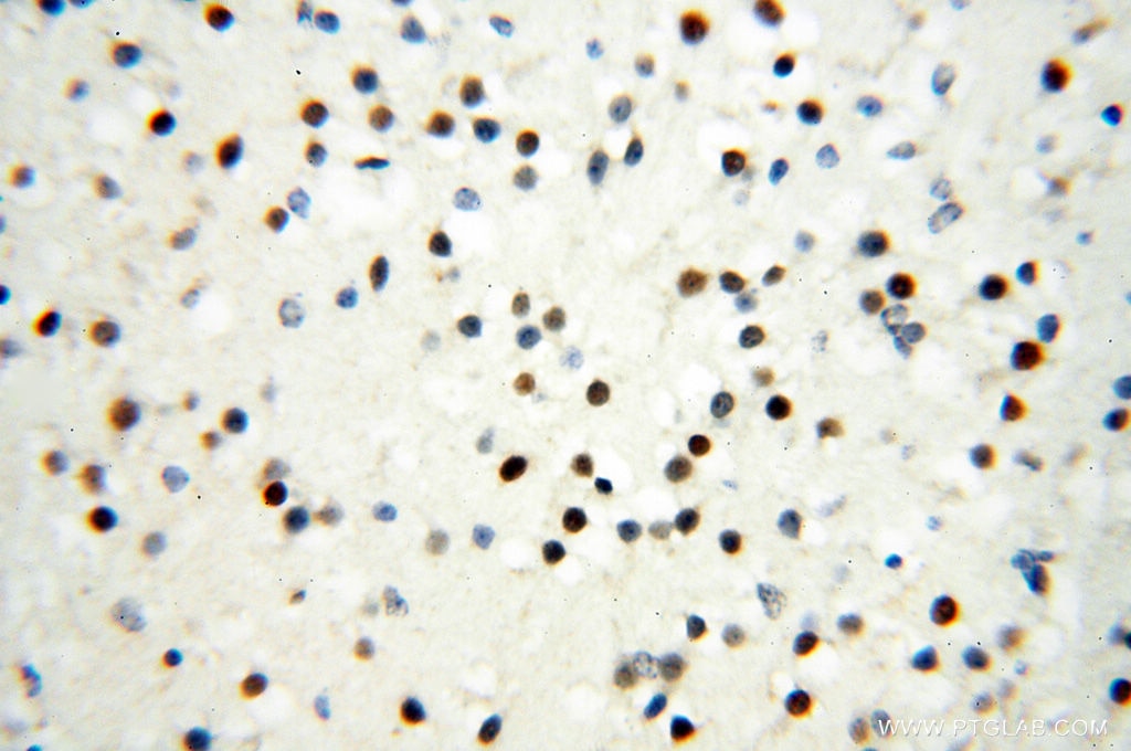 Immunohistochemistry (IHC) staining of human brain tissue using RBM3 Polyclonal antibody (14363-1-AP)