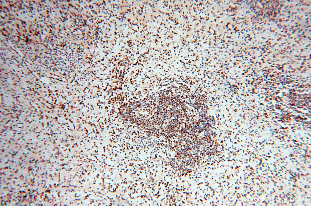 IHC staining of human spleen using 14363-1-AP