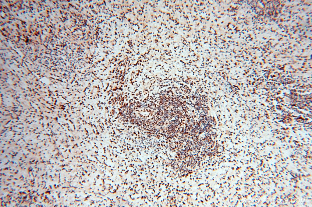 Immunohistochemistry (IHC) staining of human spleen tissue using RBM3 Polyclonal antibody (14363-1-AP)