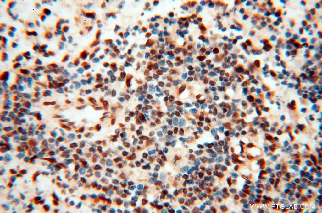 Immunohistochemistry (IHC) staining of human spleen tissue using RBM3 Polyclonal antibody (14363-1-AP)