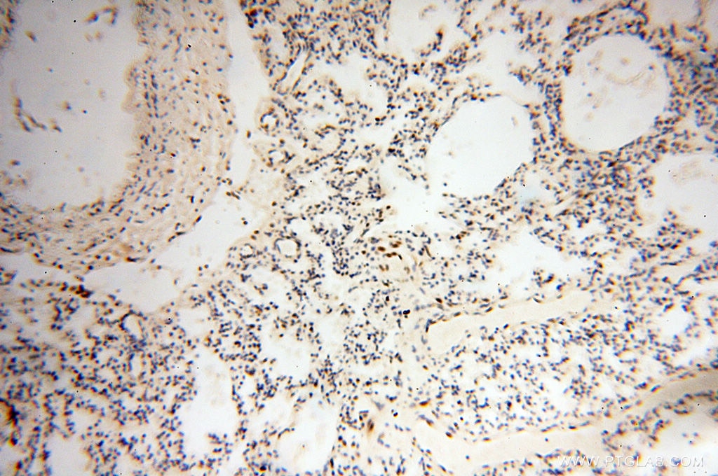 Immunohistochemistry (IHC) staining of human lung tissue using RBM3 Polyclonal antibody (14363-1-AP)