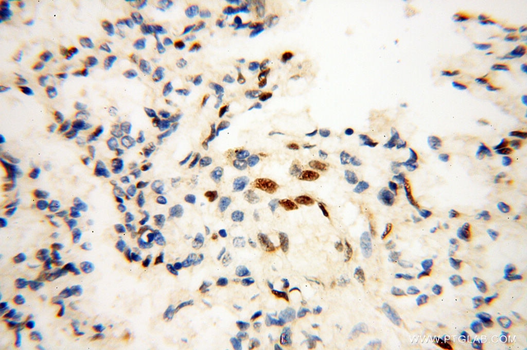 Immunohistochemistry (IHC) staining of human lung tissue using RBM3 Polyclonal antibody (14363-1-AP)