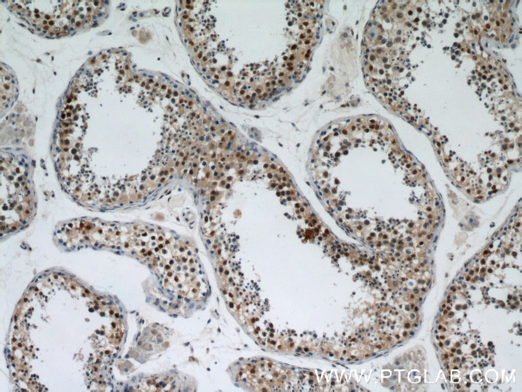 Immunohistochemistry (IHC) staining of human testis tissue using RBM3 Polyclonal antibody (14363-1-AP)