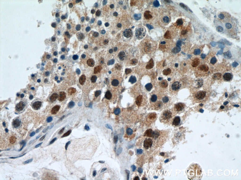 Immunohistochemistry (IHC) staining of human testis tissue using RBM3 Polyclonal antibody (14363-1-AP)