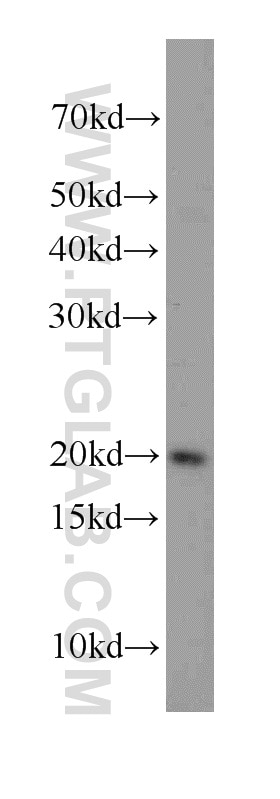 Western Blot (WB) analysis of MCF-7 cells using RBM3 Polyclonal antibody (14363-1-AP)