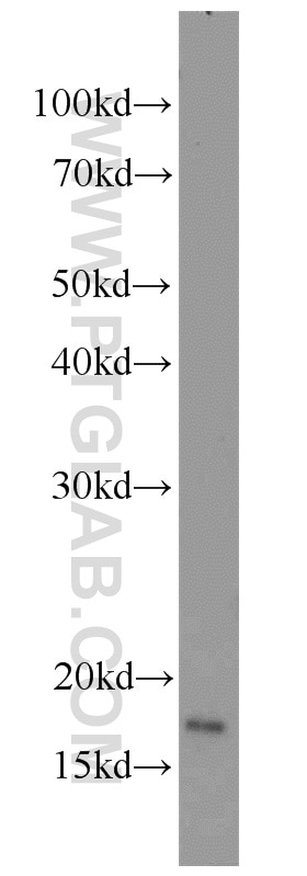 Western Blot (WB) analysis of A375 cells using RBM3 Polyclonal antibody (14363-1-AP)