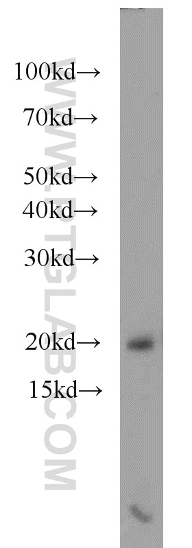 Western Blot (WB) analysis of Raji cells using RBM3 Polyclonal antibody (14363-1-AP)