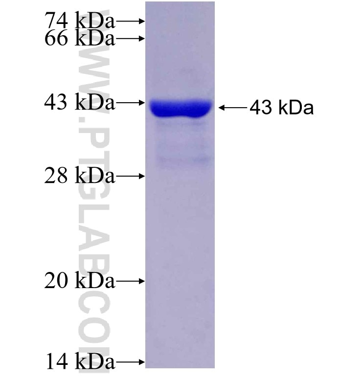 RBM3 fusion protein Ag5934 SDS-PAGE