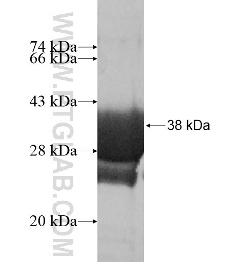 RBM33 fusion protein Ag12340 SDS-PAGE