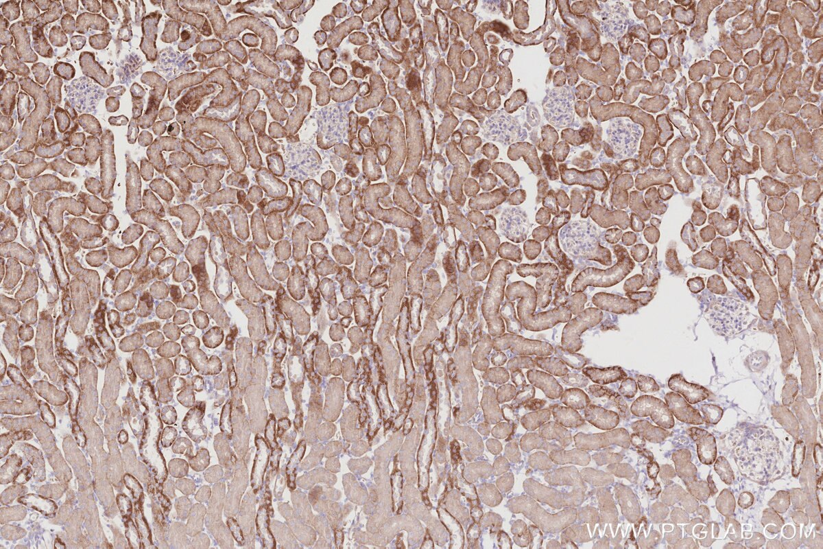 IHC staining of mouse kidney using 16435-1-AP Immunohistochemistry (IHC) staining of mouse kidney tissue using RBM38 Polyclonal antibody (16435-1-AP)