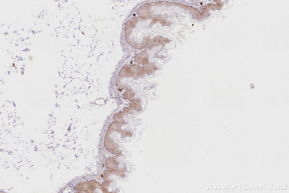 IHC staining of mouse stomach using 16435-1-AP Immunohistochemistry (IHC) staining of mouse stomach tissue using RBM38 Polyclonal antibody (16435-1-AP)