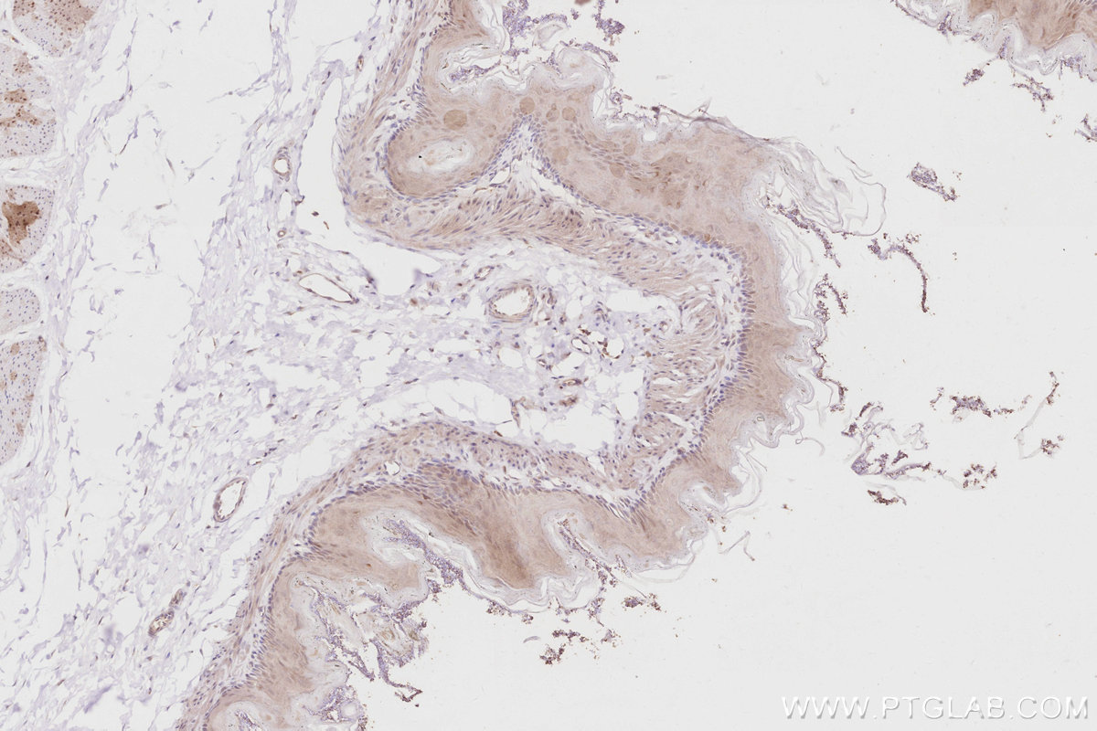 IHC staining of rat stomach using 16435-1-AP Immunohistochemistry (IHC) staining of rat stomach tissue using RBM38 Polyclonal antibody (16435-1-AP)