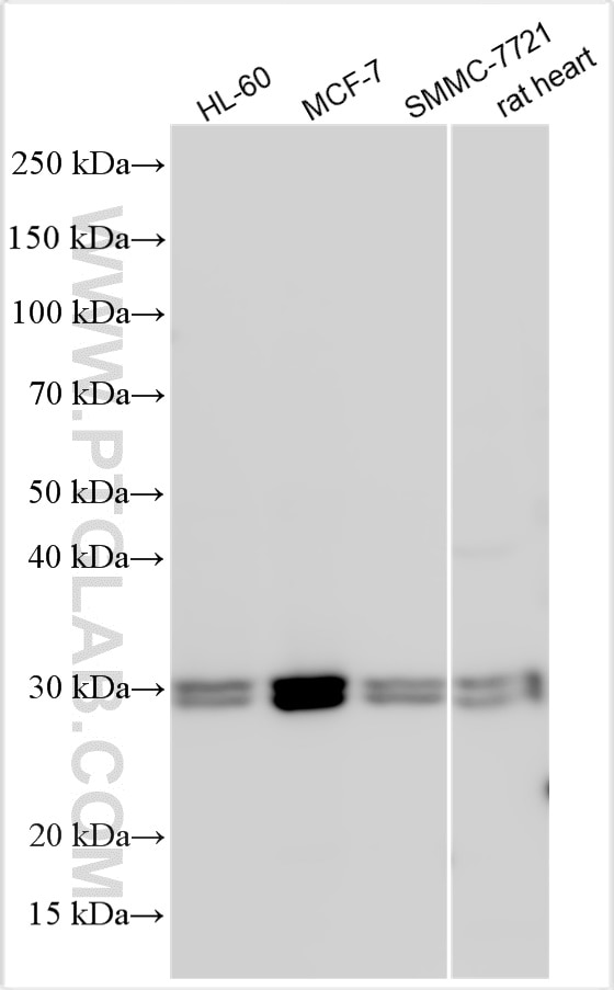 Western Blot (WB) analysis of various lysates using RBM38 Polyclonal antibody (16435-1-AP)