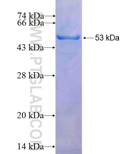 RBM38 fusion protein Ag9748 SDS-PAGE