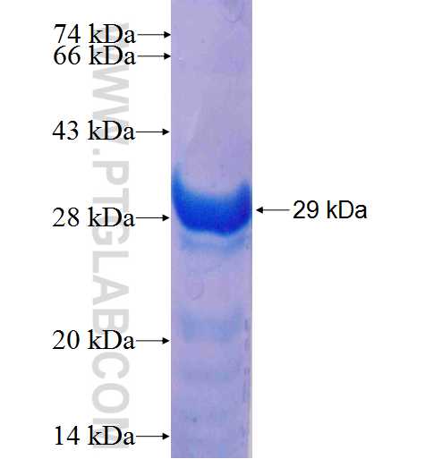 RBM38 fusion protein Ag9911 SDS-PAGE