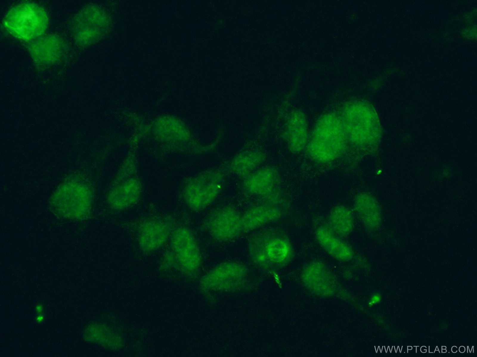 Immunofluorescence (IF) / fluorescent staining of HEK-293 cells using RBM39 Polyclonal antibody (21339-1-AP)