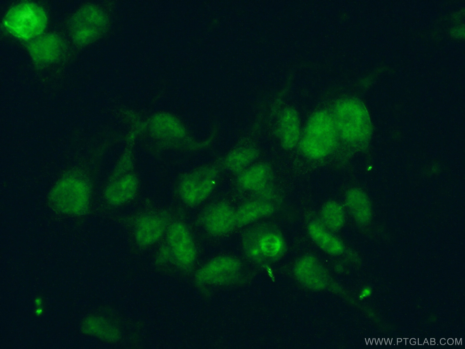 IF Staining of HEK-293 using 21339-1-AP