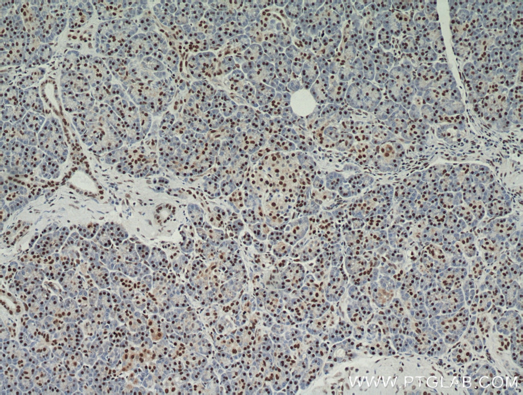 Immunohistochemistry (IHC) staining of human pancreas tissue using RBM39 Polyclonal antibody (21339-1-AP)